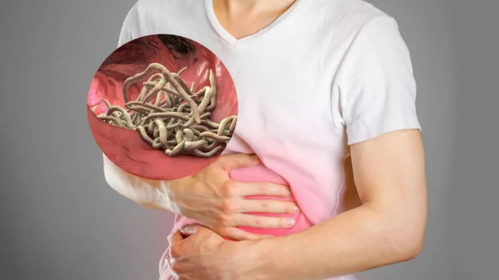 ¿Tienes sintoma parasitos intestinales? Descubre cómo reconocerlos y eliminarlos Síntomas de Parásitos Intestinales